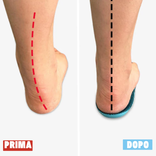 Piedevivo™ - Vivi senza dolore, senza cure costose o visite mediche...